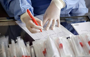 Koronavirus qurbanlarının sayı 34 mini keçdi