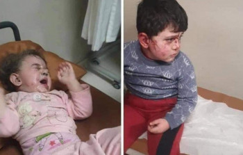 Sentyabrın 27-dən düşmən atəşi nəticəsində 8 uşaq həlak olub - RƏSMİ