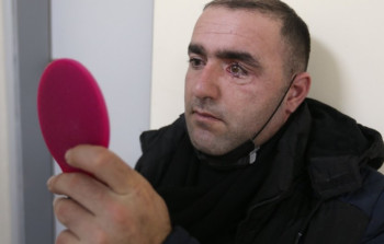 İsrailli həkimlər Vətən müharibəsi qazisini protez gözlə təmin etdi